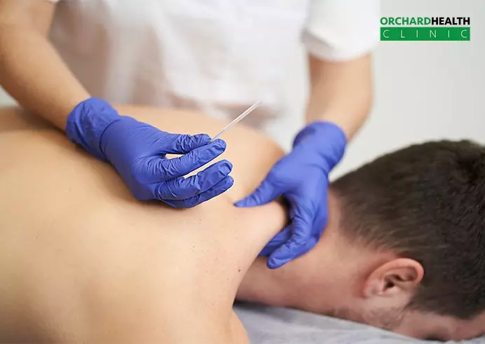Dry Needling Therapy What It Can Help Treat & Its Health Benefits