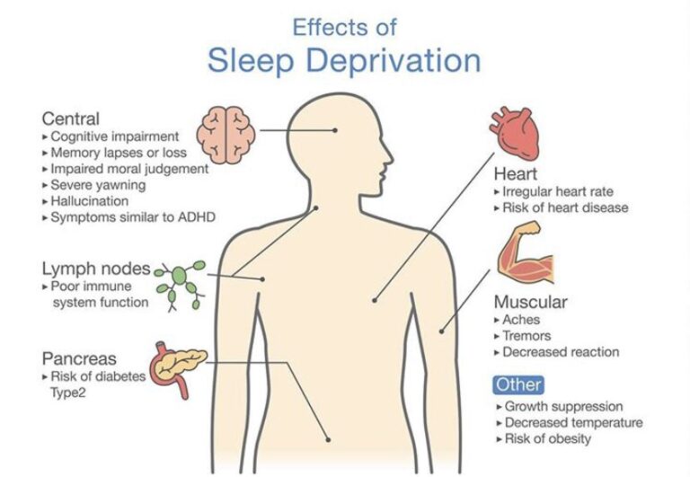 Illustration of Sleep Deprivation | Orchard Health Clinic