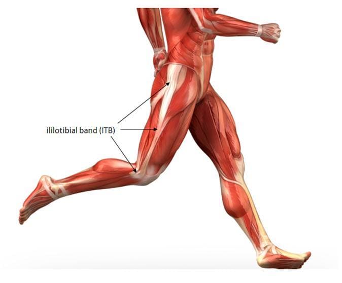 Iliotibial Band Syndrome - Orchard Health Clinic - Osteopathy