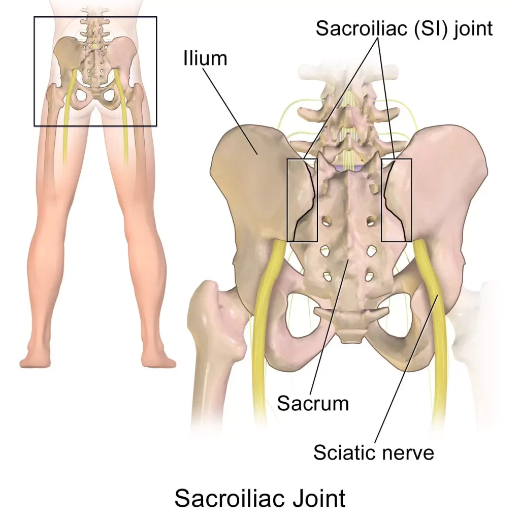 Pinched Nerve (Back)