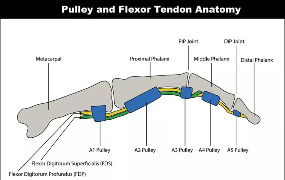 Pulley Injuries