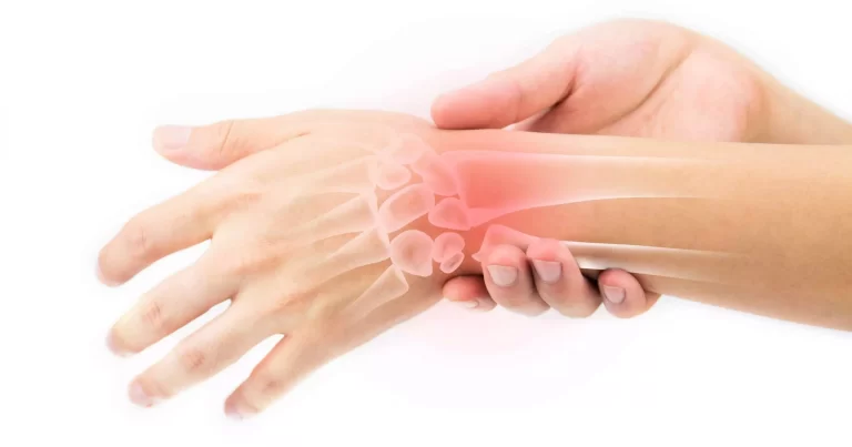 Repetitive Strain Injury (RSI) | Orchard Health Clinic