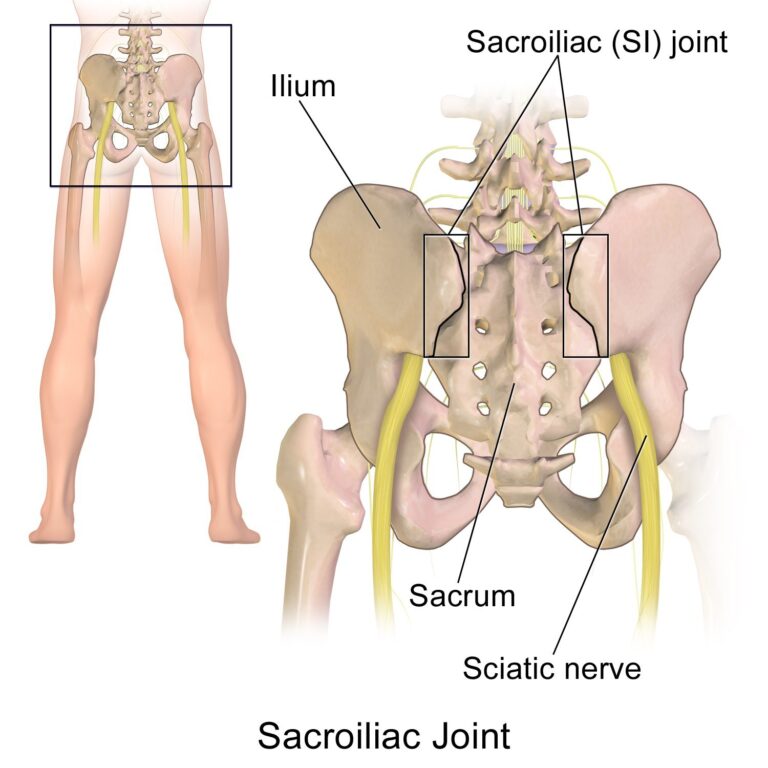 Sacroiliac Joint (SIJ) Dysfunction | Orchard Health Clinic