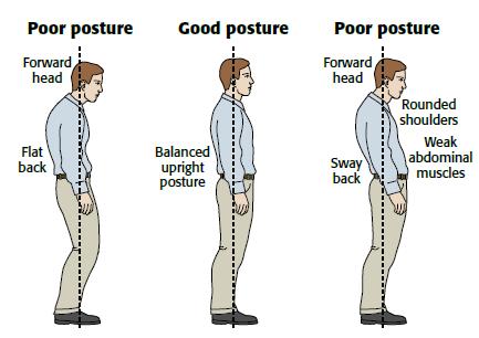 Back Postural Stresses | Orchard Health Clinic