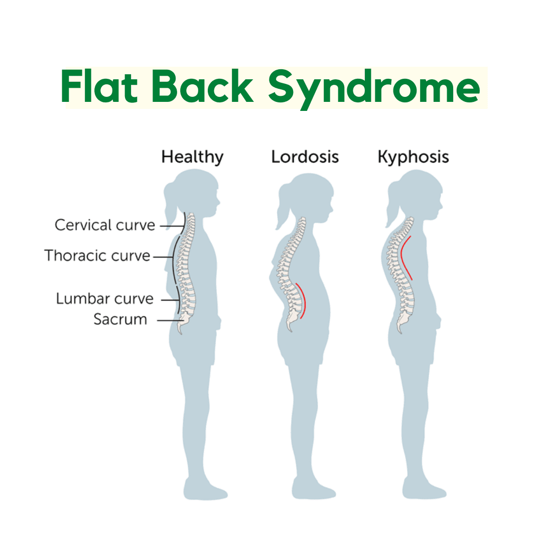 Flat back store