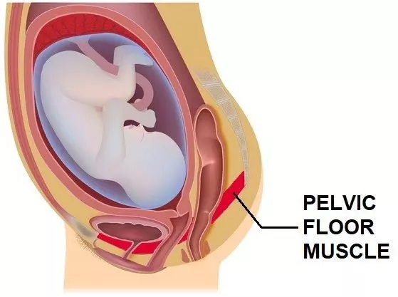 illustration of pelvic floor muscle in pregnancy | Pelvic Floor Treatment