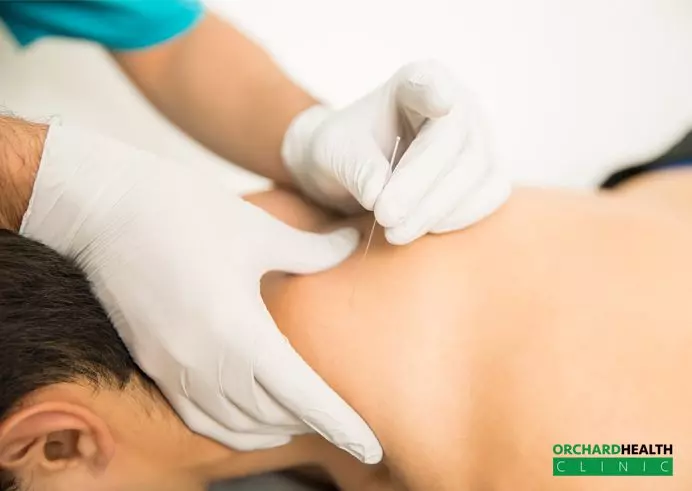 Dry Needling Therapy What You Should Know | Orchard Health Clinic