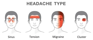 Types of Head Ache | Orchard Health Clinic