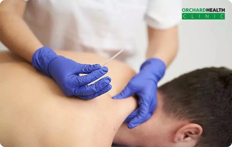 Dry-Needling-Therapy-What-It-Can-Help-Treat-Its-Health-Benefits