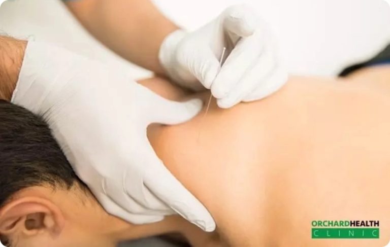 Dry-Needling-Therapy-What-You-Should-Know