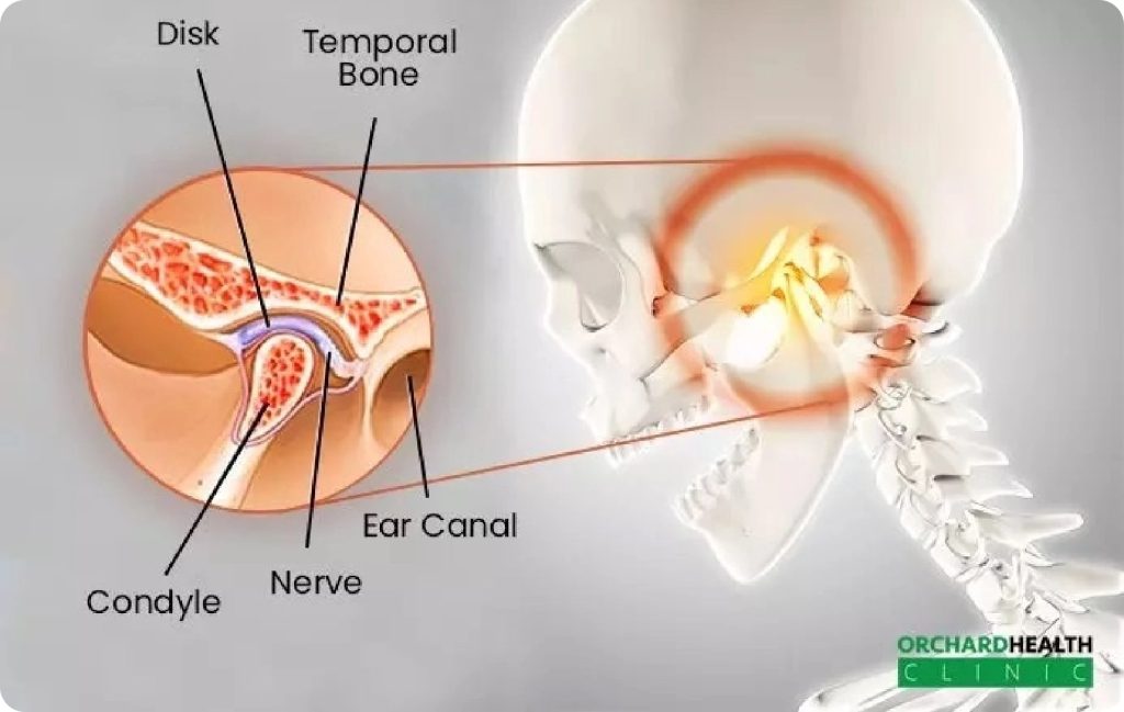 TMJ-disorder-Symptoms-and-causes-TMJ-treatment