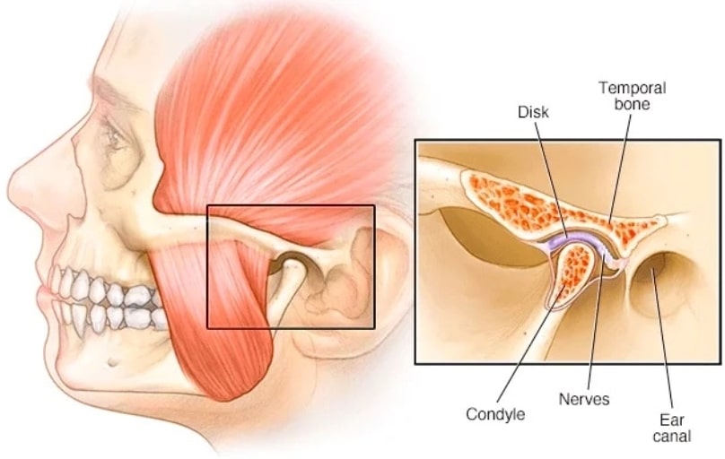 temporomandibular-joint-dysfunction